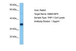 EBNA1BP2 Rabbit anti-Human, Polyclonal, Novus Biologicals 0.1ml; Unconjugated:Antibodies,